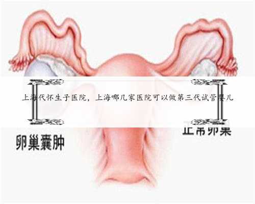 上海代怀生子医院，上海哪几家医院可以做第三代试管婴儿