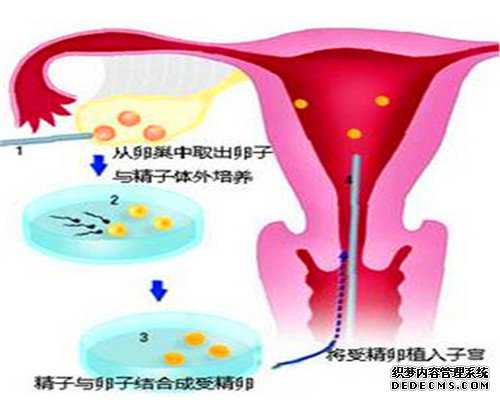 代孕生儿子-助孕资讯aa69-助孕流程是什么