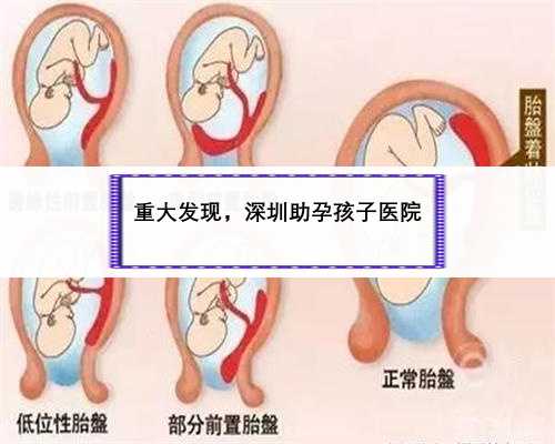 重大发现，深圳助孕孩子医院